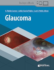 Papel Glaucoma