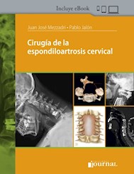 E-Book Cirugía De La Espondiloartrosis Cervical (Ebook)