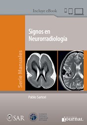 Papel Signos En Neurorradiología