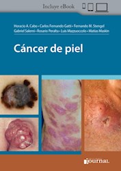 E-Book Cáncer De Piel (Ebook)