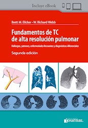 Papel Fundamentos De Tc De Alta Resolución Pulmonar