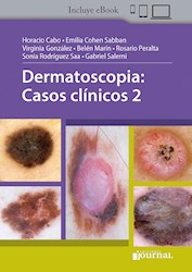 E-Book Dermatoscopia: Casos Clínicos 2 (Ebook)