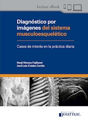 E-Book Diagnóstico Por Imágenes Del Sistema Musculoesquelético (Ebook)