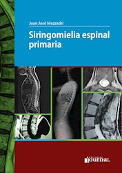 Papel Siringomielia Espinal Primaria