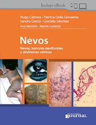 E-Book Nevos (Ebook)