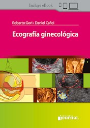 Papel Ecografía Ginecológica