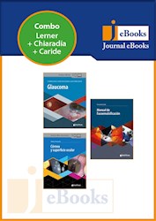 E-Book Colección Oftalmología (Ebook)