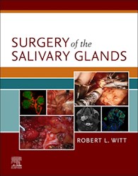 E-book Surgery Of The Salivary Glands