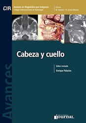 E-Book Avances En Diagnóstico Por Imágenes: Cabeza Y Cuello (Ebook)