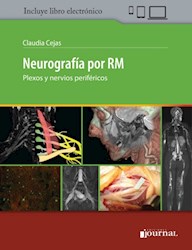 E-Book Neurografía Por Rm (Ebook)