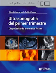 E-Book Ultrasonografía Del Primer Trimestre (Ebook)