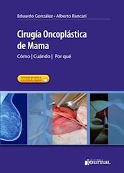 E-Book Cirugía Oncoplástica De Mama (Ebook)