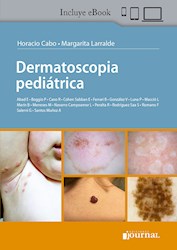 E-Book Dermatoscopia Pediátrica (Ebook)