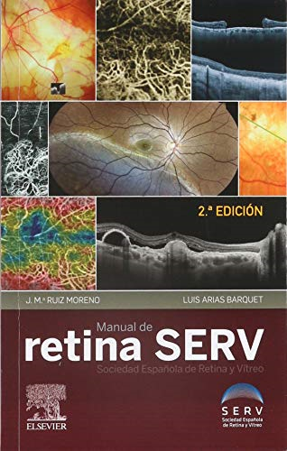 Papel Manual De Retina Serv 2 Ed.