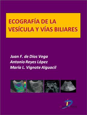 E-book Ecografía De La Vesícula Y Vías Biliares