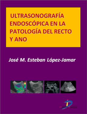 E-book Ultrasonografía Endoscópica En La Patología Del Recto Y Ano